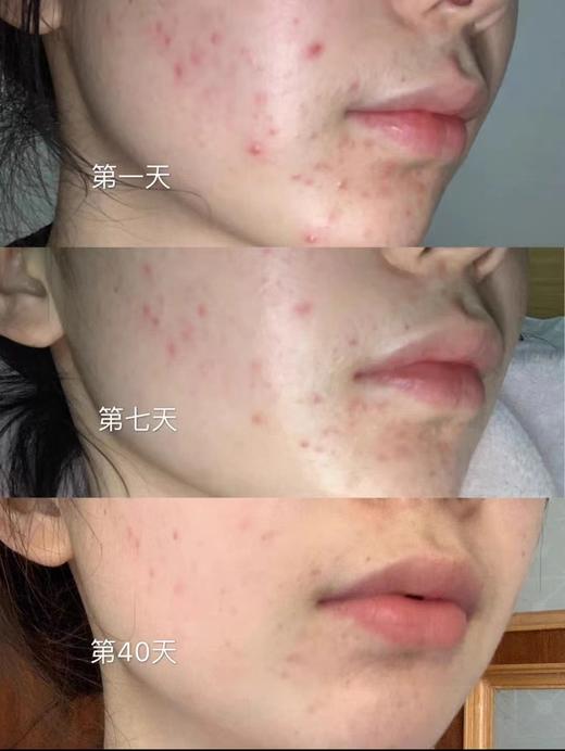 修丽可色修精华祛痘印 暗黄 商品图12