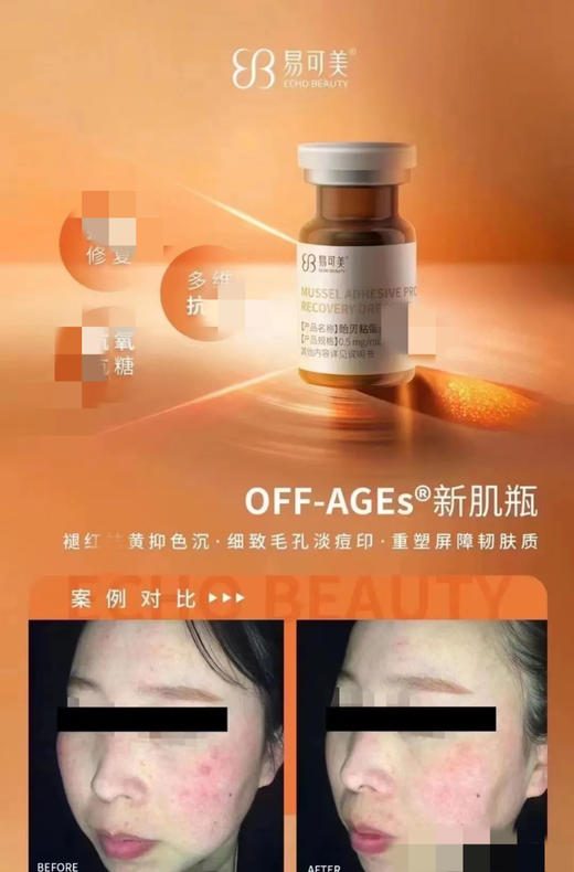 易可美新肌瓶3ml单支水光滚针痘痘闭口粉刺敏感泛红修复 商品图7