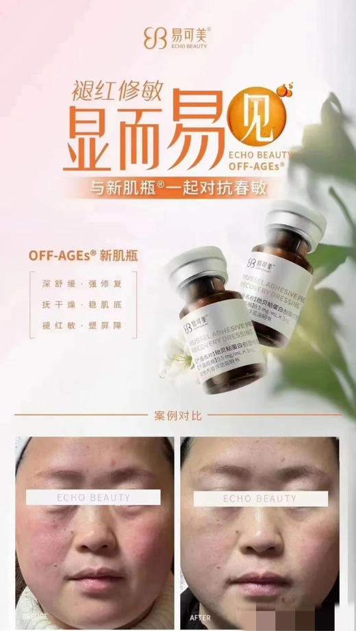 易可美新肌瓶3ml单支水光滚针痘痘闭口粉刺敏感泛红修复 商品图9