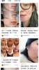 修丽可色修精华祛痘印 暗黄 商品缩略图13