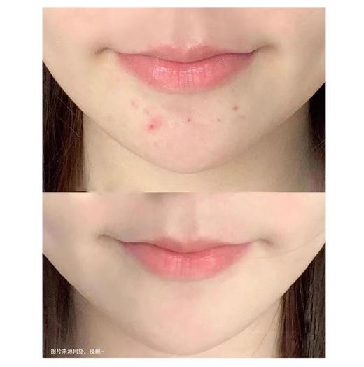 修丽可色修精华祛痘印 暗黄 商品图11