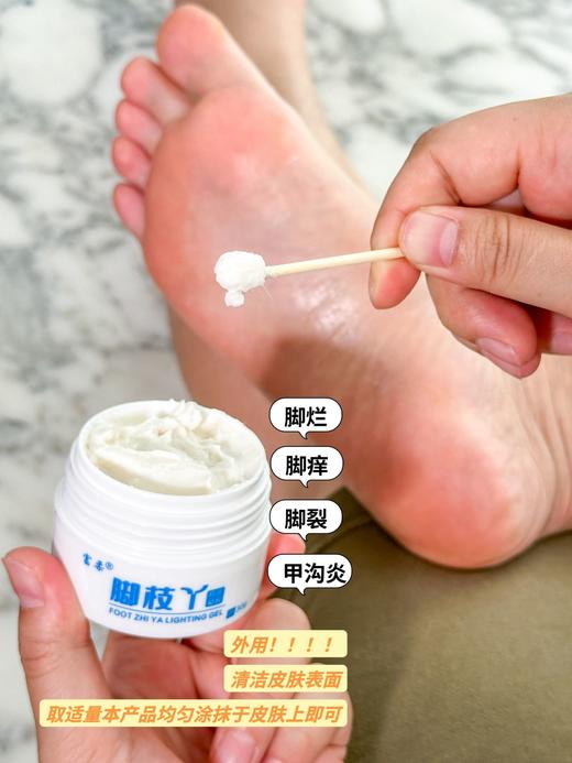 【脚枝丫导光凝胶】告别脚痒、脚烂、脚臭、脚裂、甲沟炎、蜕皮 中草yao配方 30g/瓶 商品图7