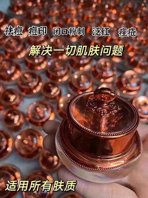 (全.网.独.家)神仙膏祖.传专治烂脸去痘膏去痘红肿青春痘闭口粉刺痘印学生脸部后背 商品图2