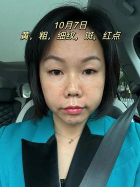 记录兮粉会员90天分肤定制· 一对一调肤的真实历程！！