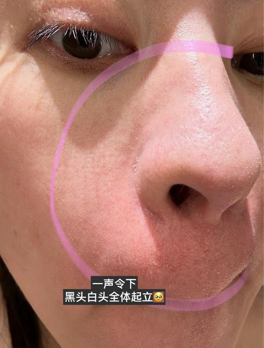 可复美ok泥膜清洁面膜  去黑头控油保湿舒缓泥膜8g/颗 商品图7