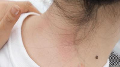 3D仿真人手揉捏肩颈按摩器~✅两种按摩模式 ✅2000MAH 续航力 ✅2档力度可轻重选择 ✅可拆布套 ✅无线自由按摩|休闲宅家好搭档~肩背带式设计解放双手！肩颈、斜方肌、腰腹，想按哪里按哪里！ 商品图13