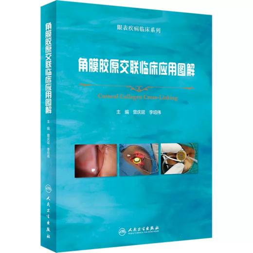 角膜胶原交联临床应用图解 角膜生物力学角膜交联交联治疗并发症及处理 商品图0