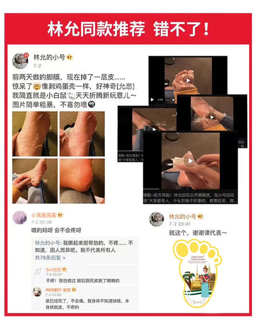 让“粗手粗脚”重焕新生！【泰国LANNA SEVEN纳兰牛奶手足膜】【买10赠1】到手11对！！ 商品图6