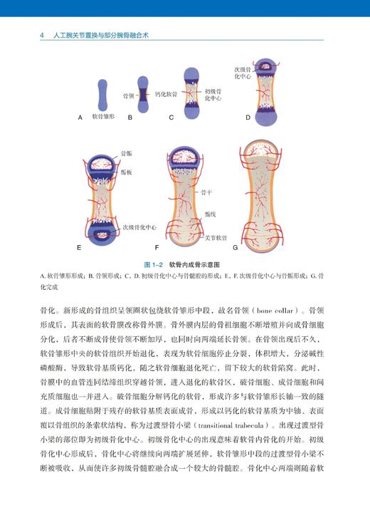 人工腕关节置换与部分腕骨融合术 徐永清 蔡兴博 陈山林 腕关节外科学 临床治疗策略 手术技巧 辽宁科学技术出版社9787559135643 商品图4