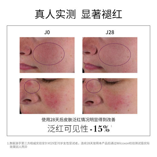 珂蒂丝舒缓修护小金瓶精华30ml敏感肌可用 商品图2