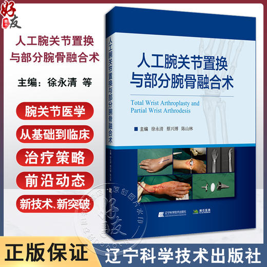 人工腕关节置换与部分腕骨融合术 徐永清 蔡兴博 陈山林 腕关节外科学 临床治疗策略 手术技巧 辽宁科学技术出版社9787559135643 商品图0