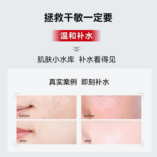 【3000 积分+299元兑换】会员专享Dr.E.Voss德沃希爽肤水200ml 商品图1
