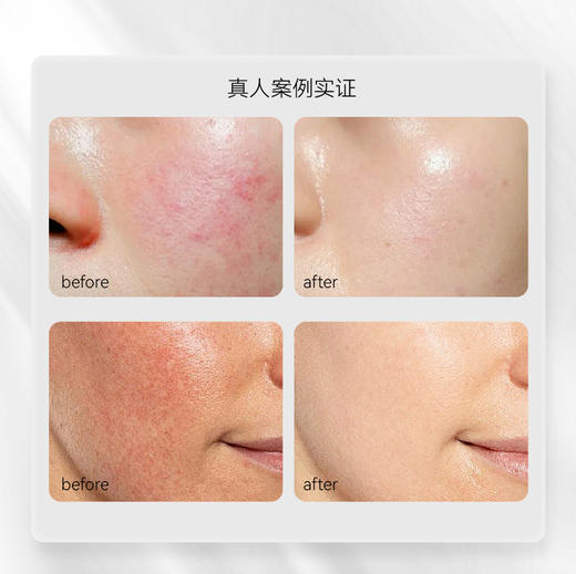 【会员专享】Dr.E.Voss德沃希 舒颜补水双子瓶|舒颜褪红精华30ml+水能弹润精华30ml 商品图3