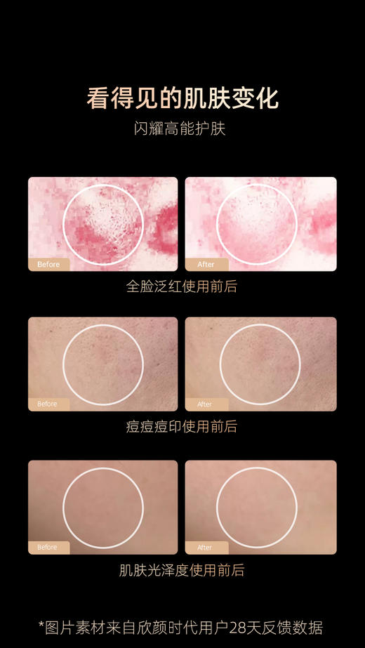 miniface第十三代星锥聚能大排灯 商品图7