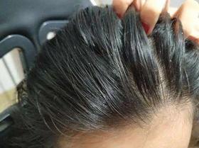  头屑多？头发油？澳洲Pote植酵舒缓专利控油去屑洗发水系列，爆卖10w+！ 