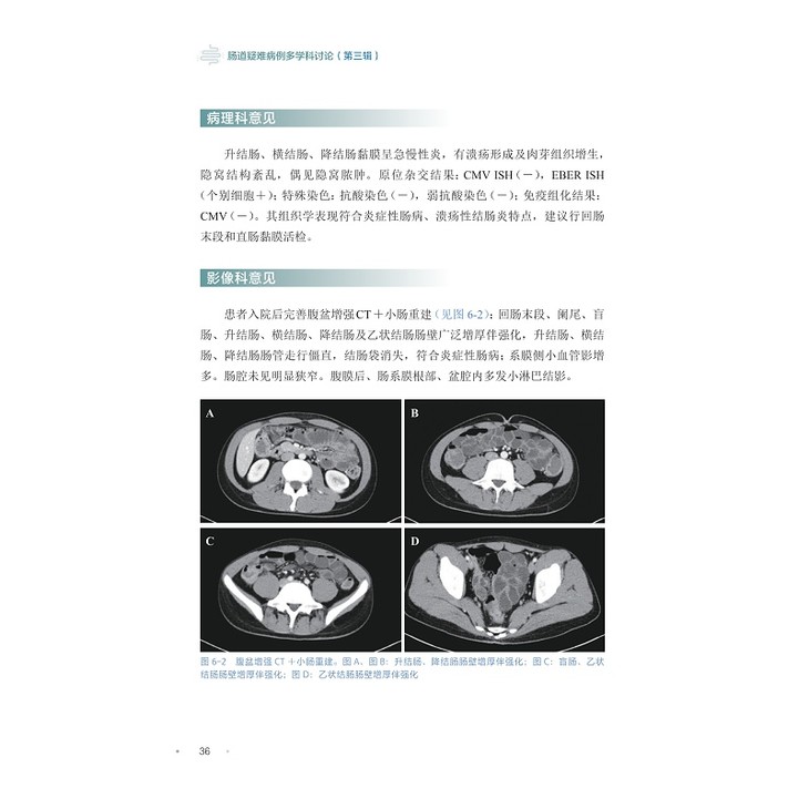 样章,肠道疑难病例多学科讨论(第三辑)_004.jpg