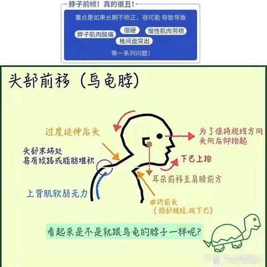 防低头族久坐护颈托脖子前倾矫正器成人扶脖子固定神器防止乌龟脖 商品图6