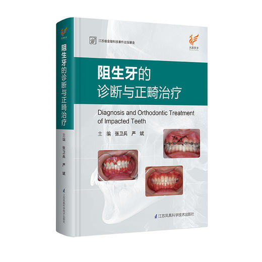 阻生牙的诊断与正畸zhi疗 商品图0