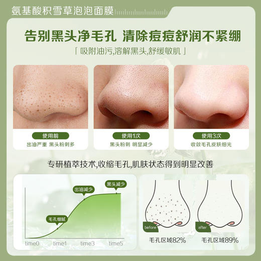 【微信会员专属】瑜然美氨基酸积雪草泡泡面膜深层清洁毛孔去黑头泥膜女官方旗舰店 商品图3