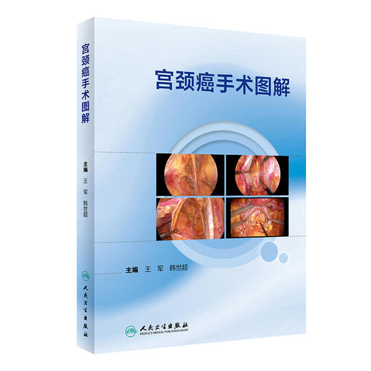 宫颈癌手术图解 商品图0