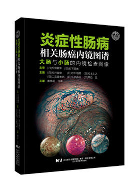 新书现货 炎症性肠病相关肠癌内镜图谱：大肠与小肠的内镜检查图像