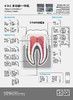 牙周治疗仪八颗牙 商品缩略图3
