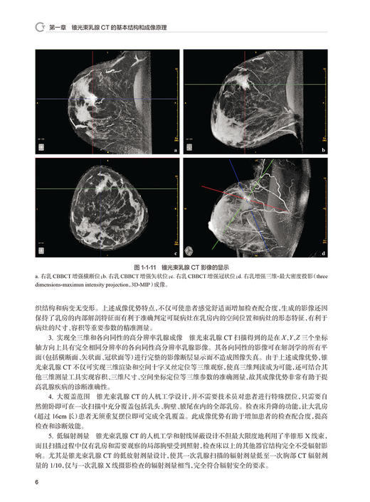 锥光束乳腺CT诊断 苏丹柯 金观桥 刘丽东 CBBCT新型乳腺诊查专用成像技术系统原理与临床诊疗应用 人民卫生出版社9787117362887 商品图4