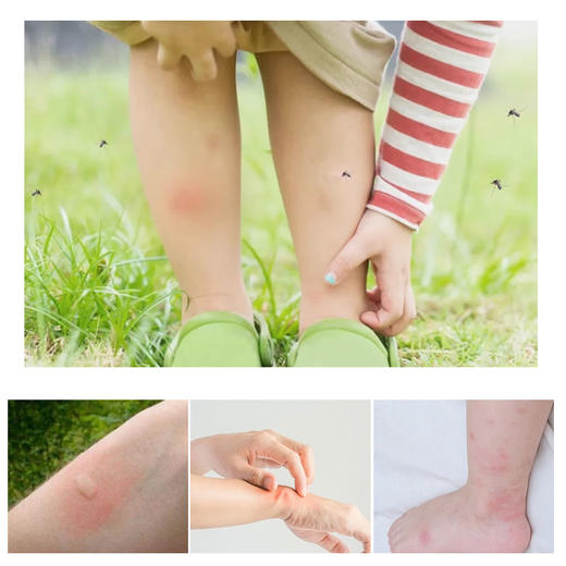 【清凉止痒，植物配方】泰国进口VINCERE香茅青草膏 0避蚊胺0酒精 婴幼儿可用 防蚊虫叮咬 提神醒脑 缓解晕眩 13g*3瓶/盒 商品图3