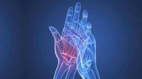  疼到要命！女人为什么比男人多两倍！ 