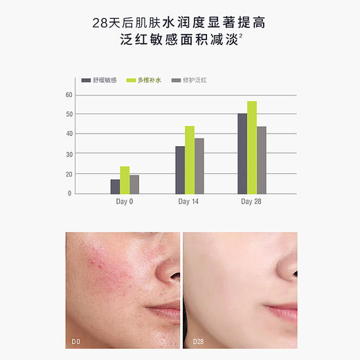 【星品福利  】冰岛水乳修复组合套 商品图4