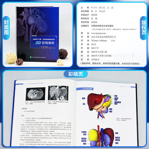 副神经节瘤 嗜铬细胞瘤病例3D影像解析 附视频 叶子兴 张玉石 文进 泌尿系肿瘤影像诊断病例 中国协和医科大学出版社9787567923546 商品图2