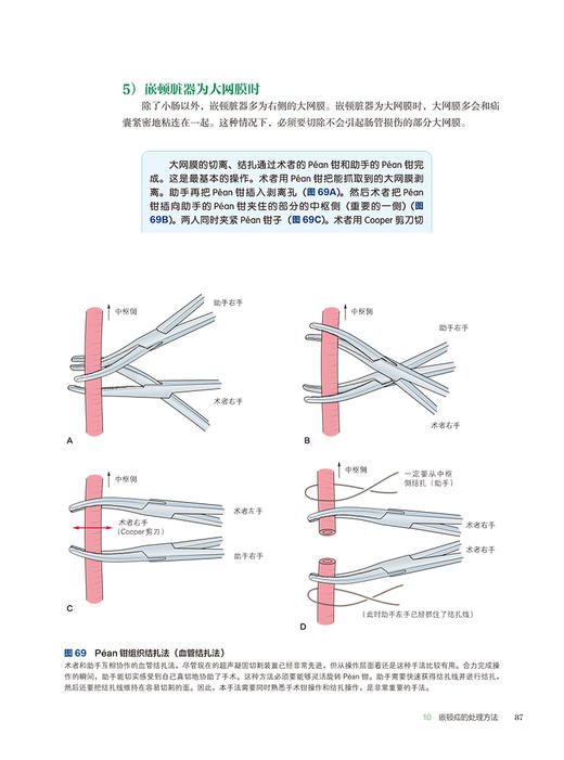 从外科基本技术和证据入手探索住院医师的疝气手术 王利 肖鹏 罗鹏飞主译 腹股沟疝手术操作方法 辽宁科学技术出版社9787559131904 商品图3