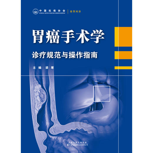 胃癌手术学：诊疗规范与操作指南 胃癌 手术 诊疗 规范 操作 指南 商品图3