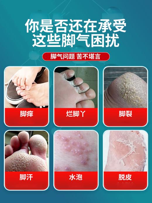 【夏日无脚臭！法国“足部清道夫”】法国Biorêve茶树精油水杨酸凝胶 珍贵天然植萃提取 4大科技成分+复合10重欧洲名贵草药 kan菌chu臭 商品图2