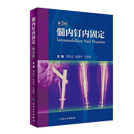 髓内钉内固定（第3版） 商品图0