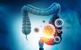 肠道疾病“喜欢”找上这3类人，希望你不在其中！