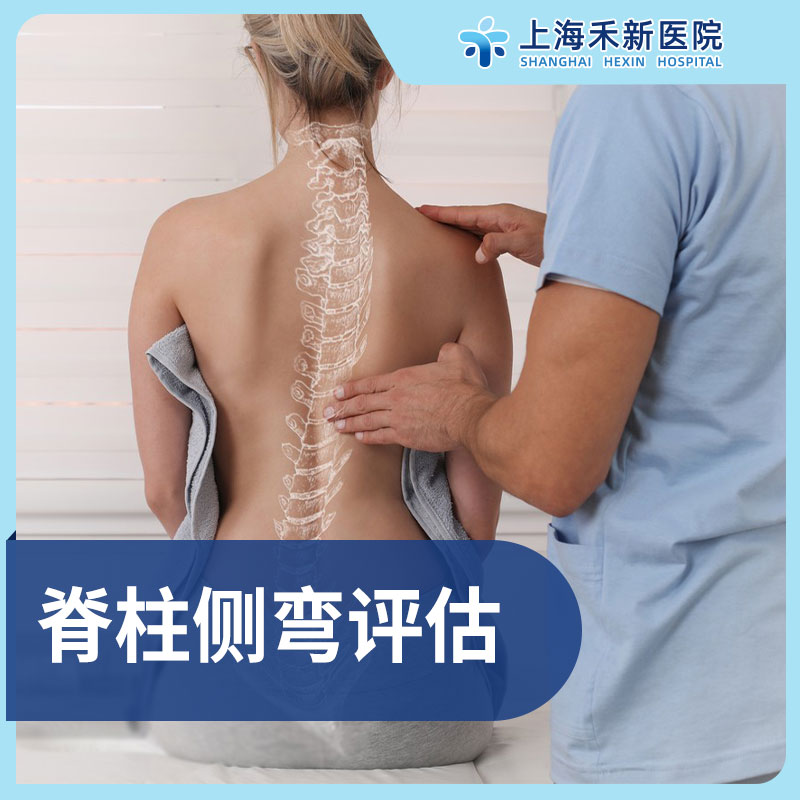 脊柱侧弯评估筛查