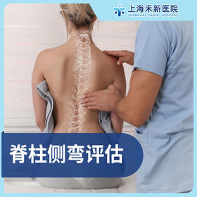脊柱侧弯评估筛查