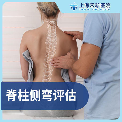 脊柱侧弯评估筛查 商品图0