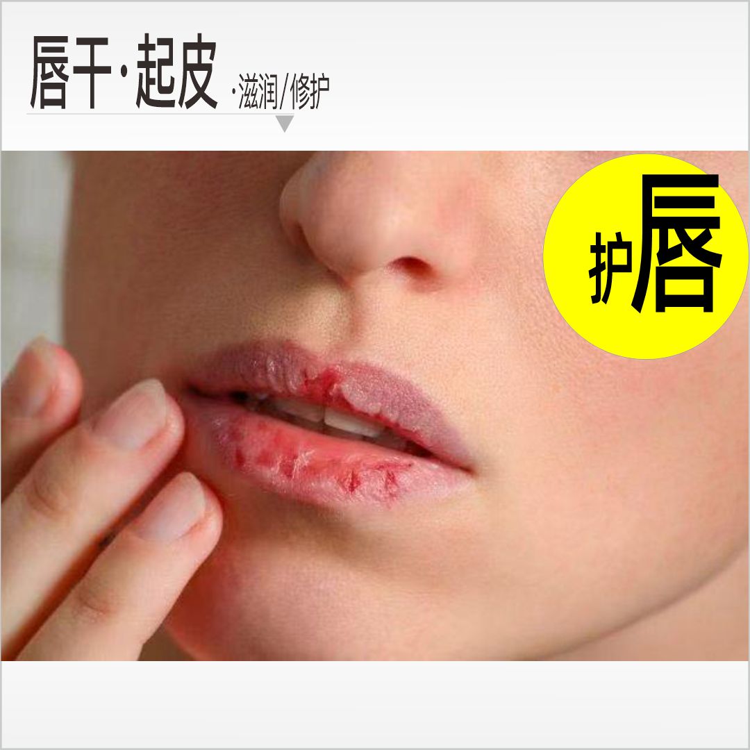 Morettie/莫嫡 _修护膏_润唇膏_嘴唇干燥起皮_凡士林润唇釉 _防干裂修护