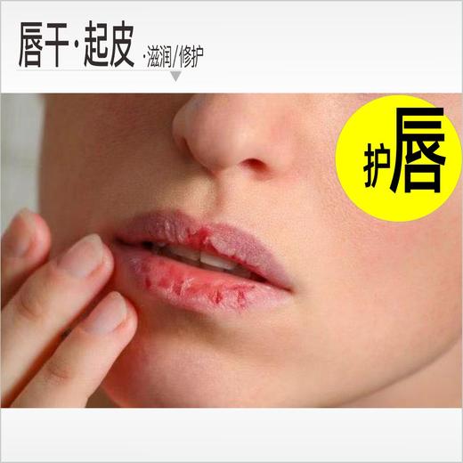 Morettie/莫嫡 _修护膏_润唇膏_嘴唇干燥起皮_凡士林润唇釉 _防干裂修护 商品图0