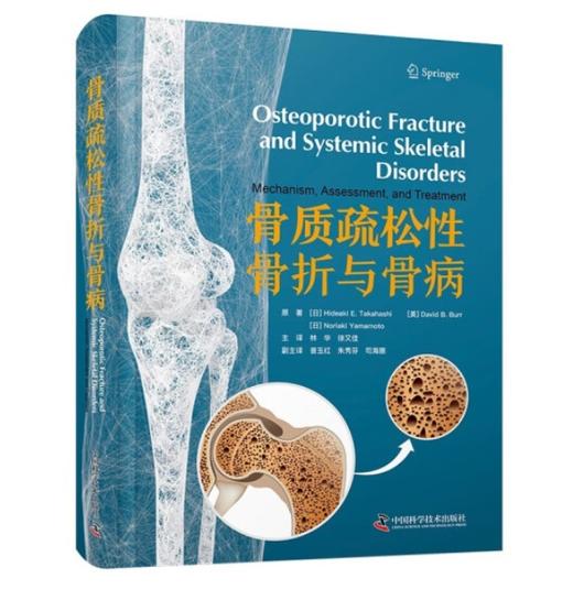 骨质疏松性骨折与骨病 商品图0