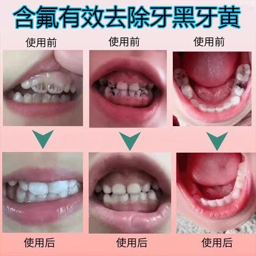 【18元会员福利】GOMISE秘素儿童果味牙膏70g益生元儿童低氟牙膏去黄防蛀去牙菌斑   商品图1