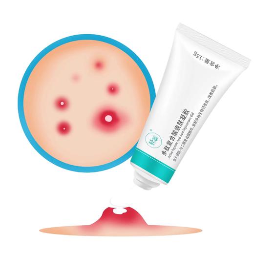 多肽复合酸焕肤凝胶15g 商品图1