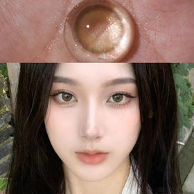 missbebe囡囡（年抛硅水）