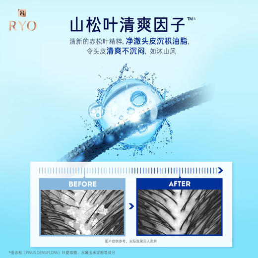 吕（Ryo）舒爽清润净澈去屑洗发水 400ml 商品图4