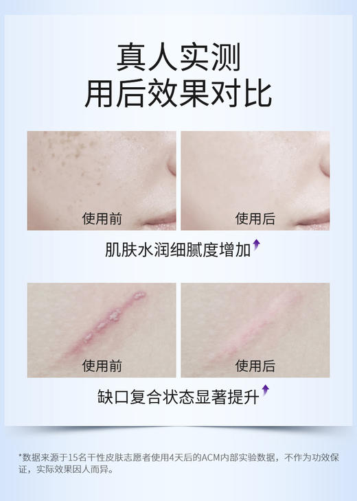 【清仓好价】法国ACM平滑修护霜面霜40ml（效期至25.1） 商品图2