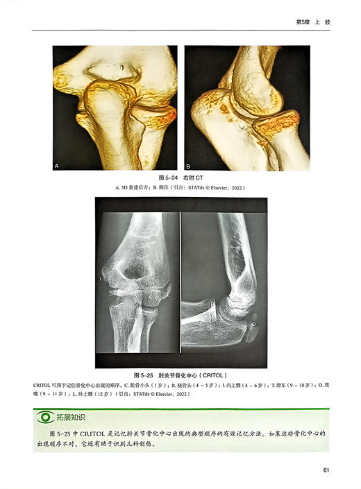 骨与关节影像 中文翻译版原书第8版 罗殿中 韦兴主译 骨与关节结构特征临床影像病理改变和创伤等内容 科学出版社9787030785039 商品图4