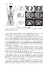 康复影像学指南 王振常 梁长虹 中国康复医学会康复医学指南丛书 不同影像表现及关注要点 影像应用 人民卫生出版社9787117357753 商品缩略图4