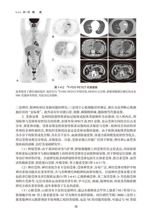 康复影像学指南 王振常 梁长虹 中国康复医学会康复医学指南丛书 不同影像表现及关注要点 影像应用 人民卫生出版社9787117357753 商品图4